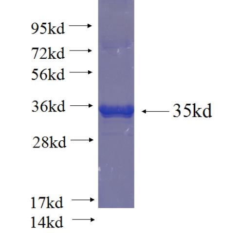Recombinant human C16orf61 SDS-PAGE