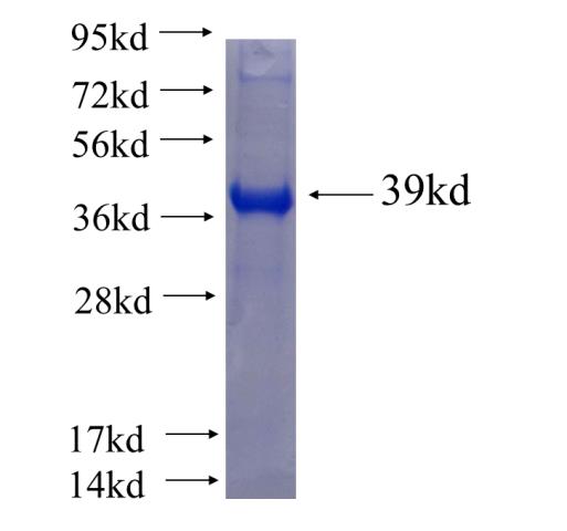 Recombinant human ALS2 SDS-PAGE