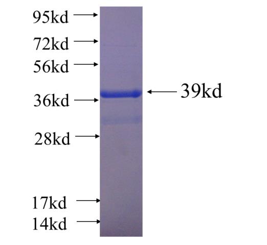 Recombinant human ZNF649 SDS-PAGE