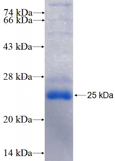 Recombinant Human ASXL2 SDS-PAGE
