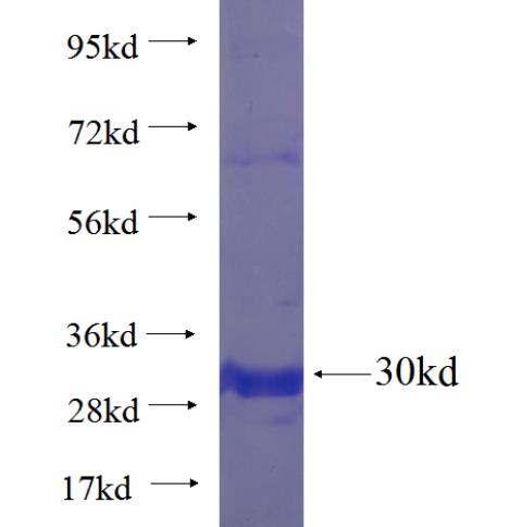 Recombinant human TRPC5 SDS-PAGE