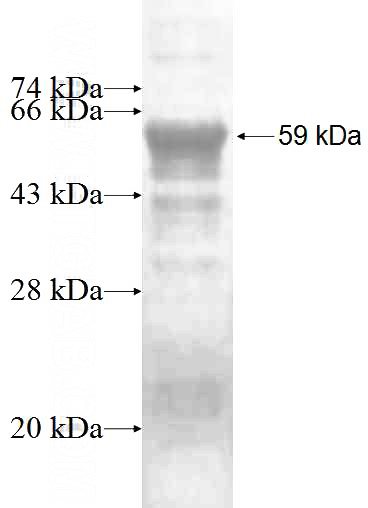 Recombinant Human PSMD3 SDS-PAGE