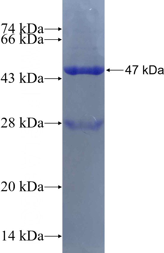 Recombinant Human TOP3B SDS-PAGE