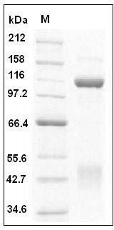 Human c-MET / HGFR Protein (His & Fc Tag) SDS-PAGE
