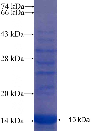 Recombinant Human BSCL2 SDS-PAGE