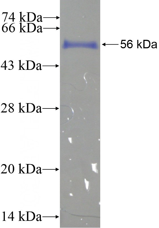 Recombinant Human MRPL28 SDS-PAGE