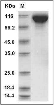 Rat EGFR / HER1 / ErbB1 Protein (His Tag) SDS-PAGE