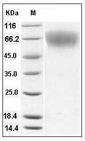 Mouse CD62L / L-Selectin / SELL Protein (His Tag) SDS-PAGE