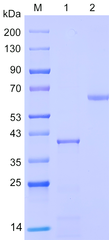 Recombinant STK10 protein (His tag) SDS-PAGE