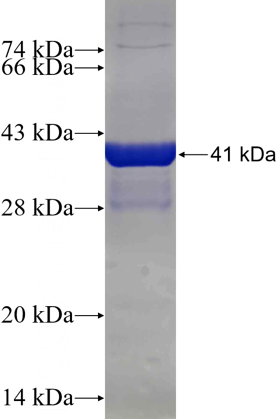 Recombinant Human HLA-E SDS-PAGE