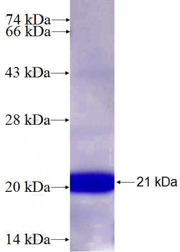 Recombinant Human ADAMTS5 SDS-PAGE