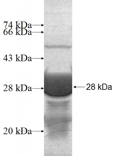 Recombinant Human NOL6 SDS-PAGE