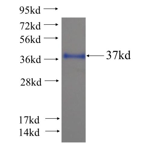 Recombinant human RRN3 SDS-PAGE
