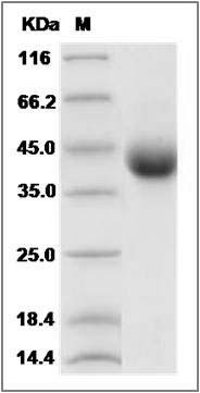 Cynomolgus TNFR2 / CD120b / TNFRSF1B Protein (His Tag) SDS-PAGE