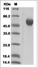 Rat SerpinA1 Protein (His Tag)