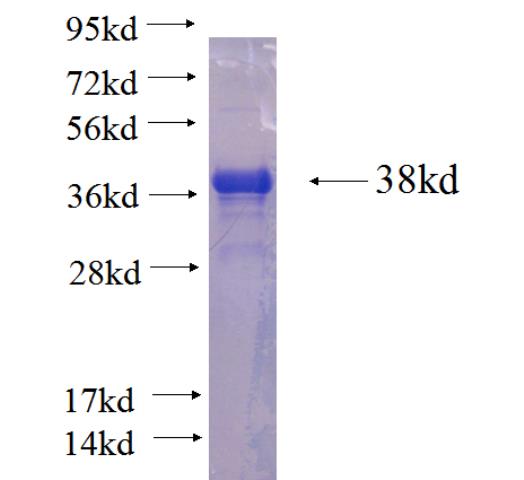 Recombinant human ZNF436 SDS-PAGE