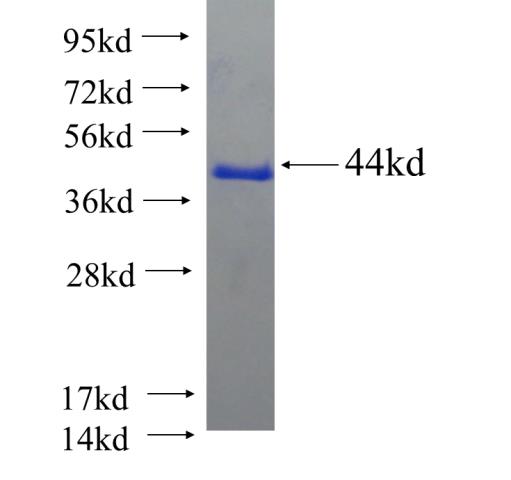 Recombinant human KLHL31 SDS-PAGE