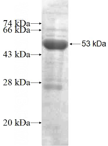 Recombinant Human MTO1 SDS-PAGE
