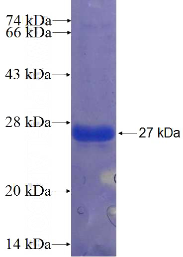 Recombinant Human KLHDC8A SDS-PAGE
