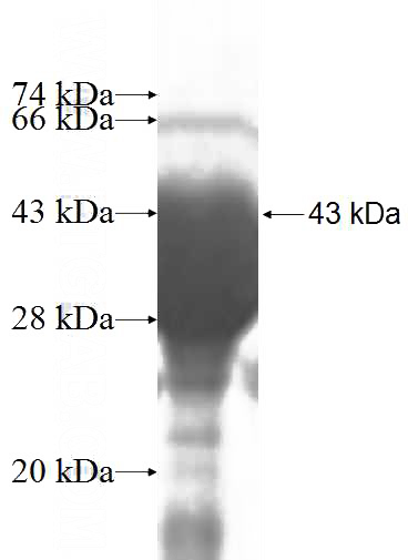 Recombinant Human NAGK SDS-PAGE