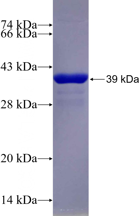 Recombinant Human ADIPOR2 SDS-PAGE