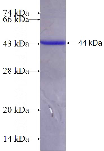 Recombinant Human ENOX2 SDS-PAGE