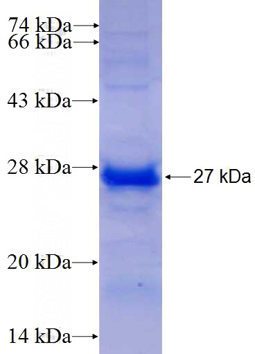 Recombinant Human YAF2 SDS-PAGE