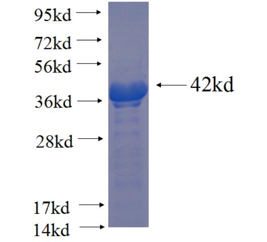 Recombinant human KIAA0586 SDS-PAGE