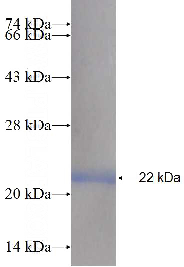 Recombinant Human CETN3 SDS-PAGE