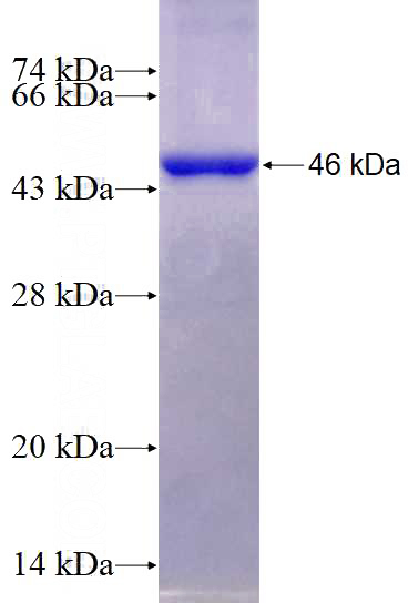 Recombinant Human TNK1 SDS-PAGE