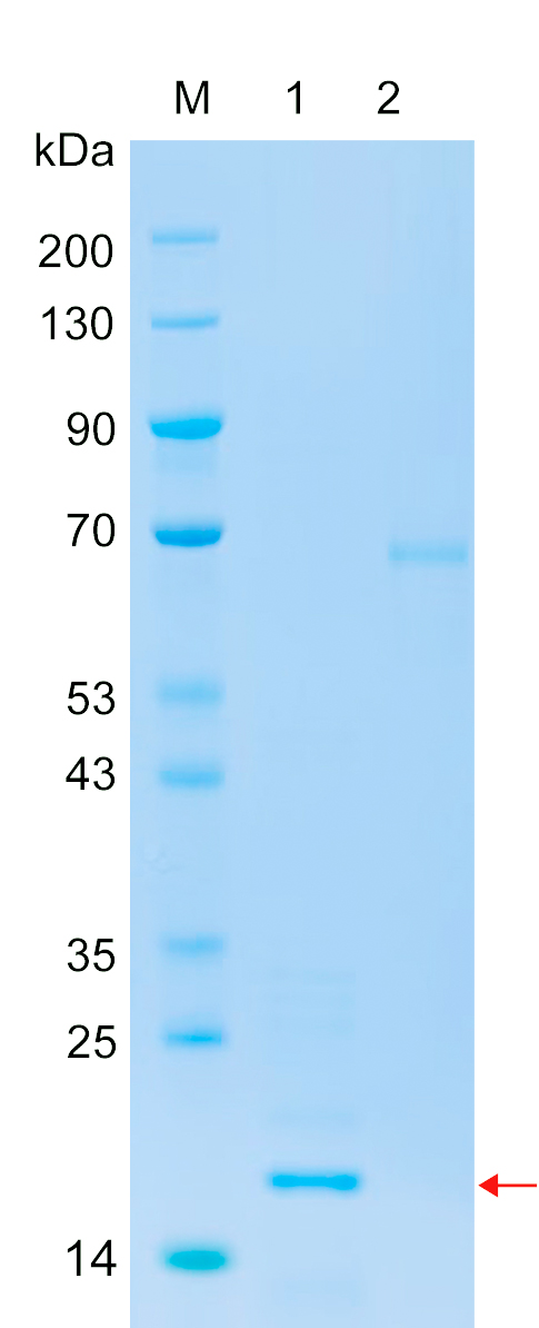 Recombinant YETS2 protein (His tag) SDS-PAGE
