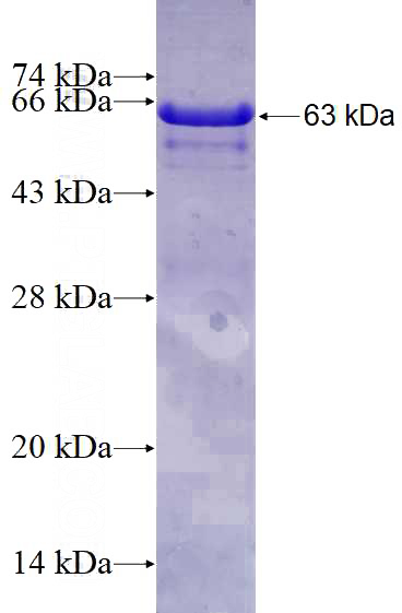Recombinant Human PCDHB16 SDS-PAGE