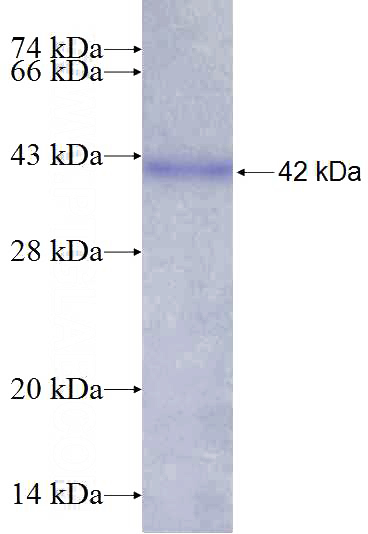 Recombinant Human ZNF143 SDS-PAGE