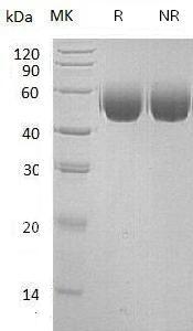 Human SIRPA/BIT/MFR/MYD1 (His tag) recombinant protein