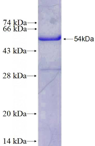 Recombinant Human CHRM2 SDS-PAGE