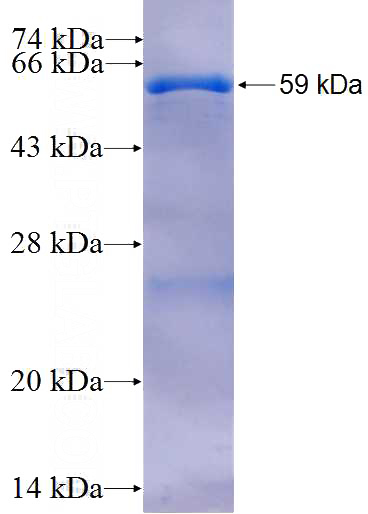 Recombinant Human SMG7 SDS-PAGE