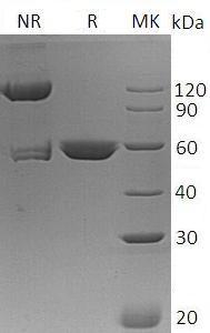 Human MINPP1/MIPP/UNQ900/PRO1917 (His tag) recombinant protein