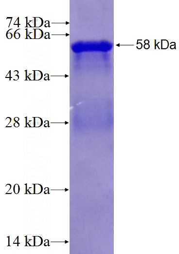 Recombinant Human UGP2 SDS-PAGE