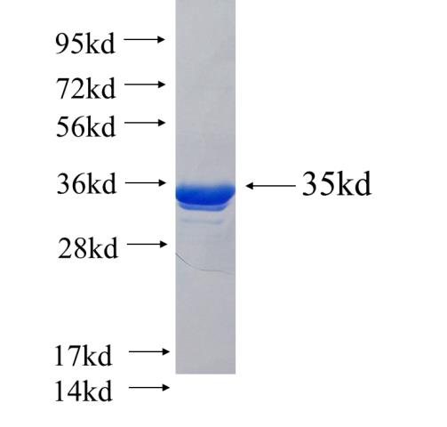 Recombinant human ZDHHC23 SDS-PAGE