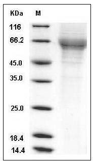 Human TIM4 / TIMD4 Protein (His Tag) SDS-PAGE