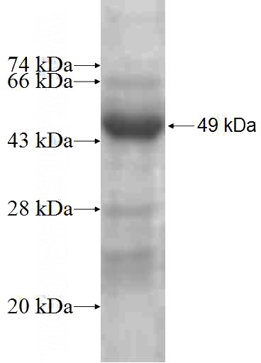 Recombinant Human MRPS10 SDS-PAGE