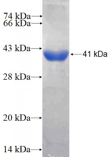 Recombinant Human LONP1 SDS-PAGE