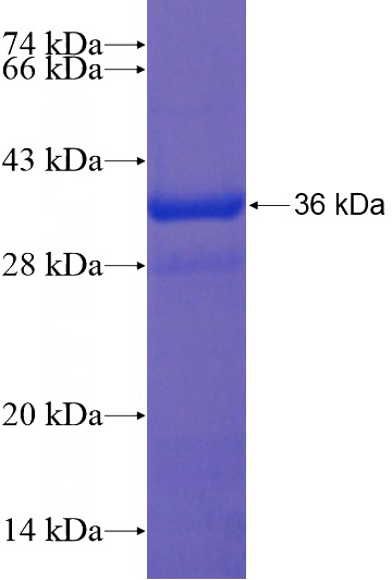 Recombinant Human MLIP SDS-PAGE