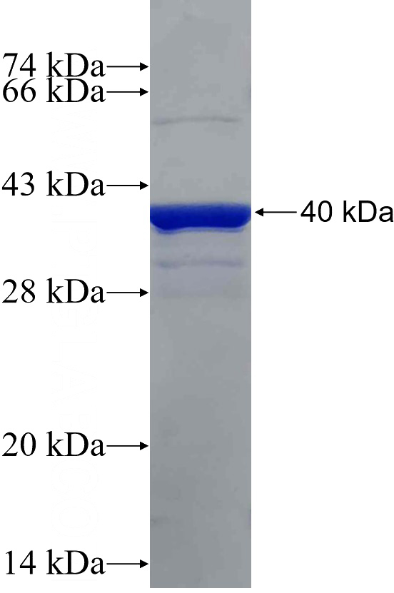Recombinant Human MMP14 SDS-PAGE