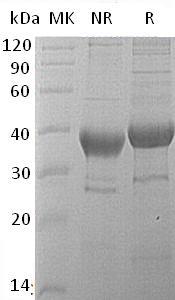 Human HABP2/HGFAL/PHBP (His tag) recombinant protein