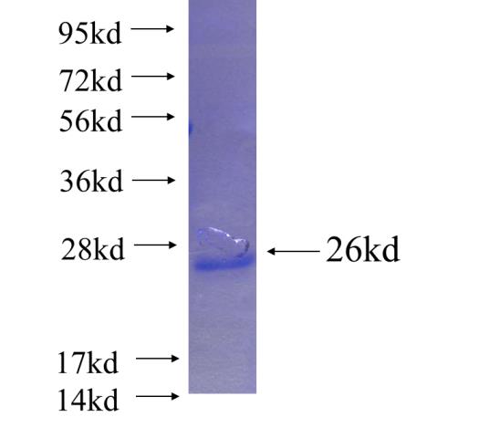 Recombinant human VPS37A SDS-PAGE