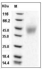 Mouse SLAMF6 / Ly108 Protein (His Tag) SDS-PAGE
