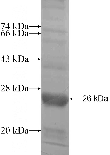 Recombinant Human CENPM SDS-PAGE