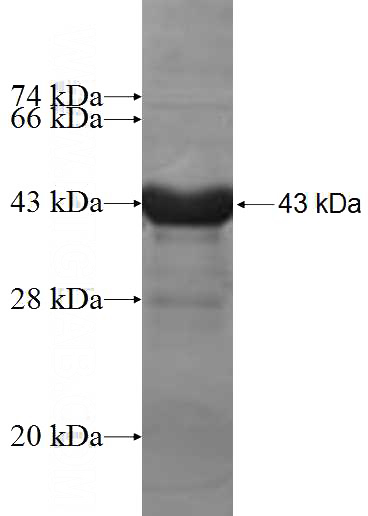 Recombinant Human MAD2L1BP SDS-PAGE