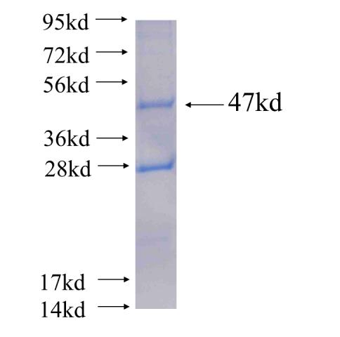 Recombinant human CRYGC(Full length) SDS-PAGE